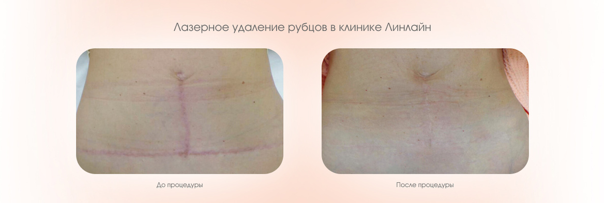 fa350e4f-4aa3-41c0-85d0-3bf634165296.jpg