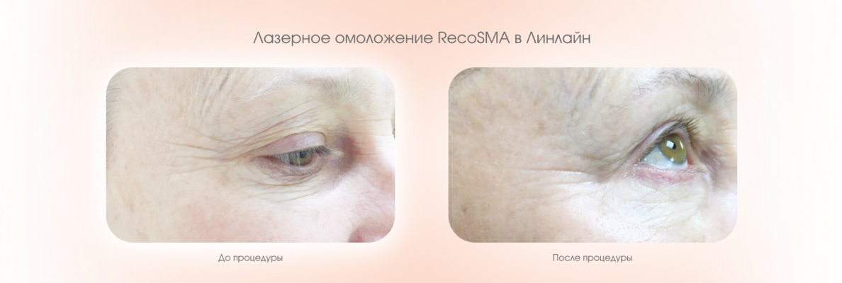 8a6ed251-ea80-490c-af0c-4a93e0d6e766.png
